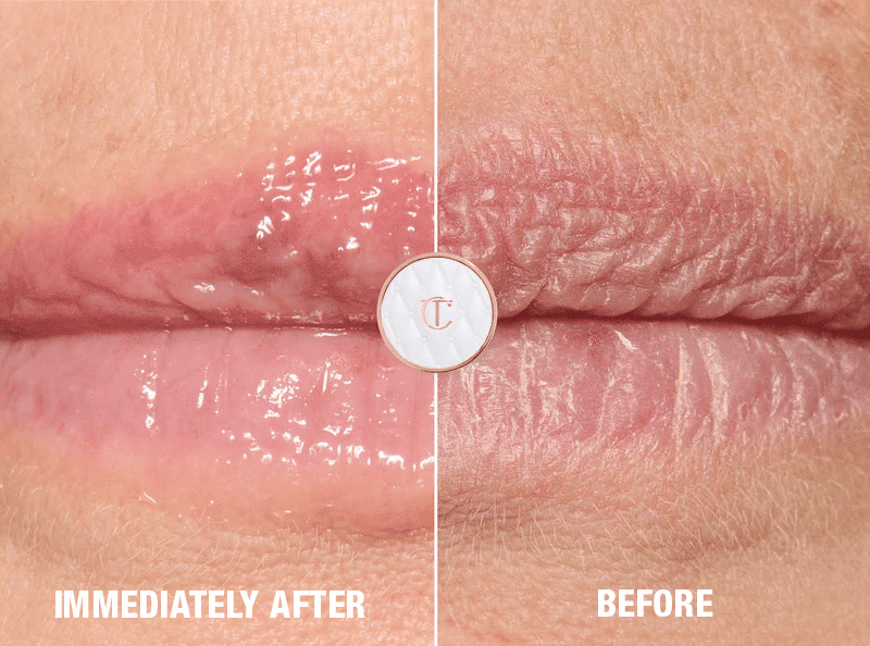 NEW! LIFE CHANGING LIP MASK