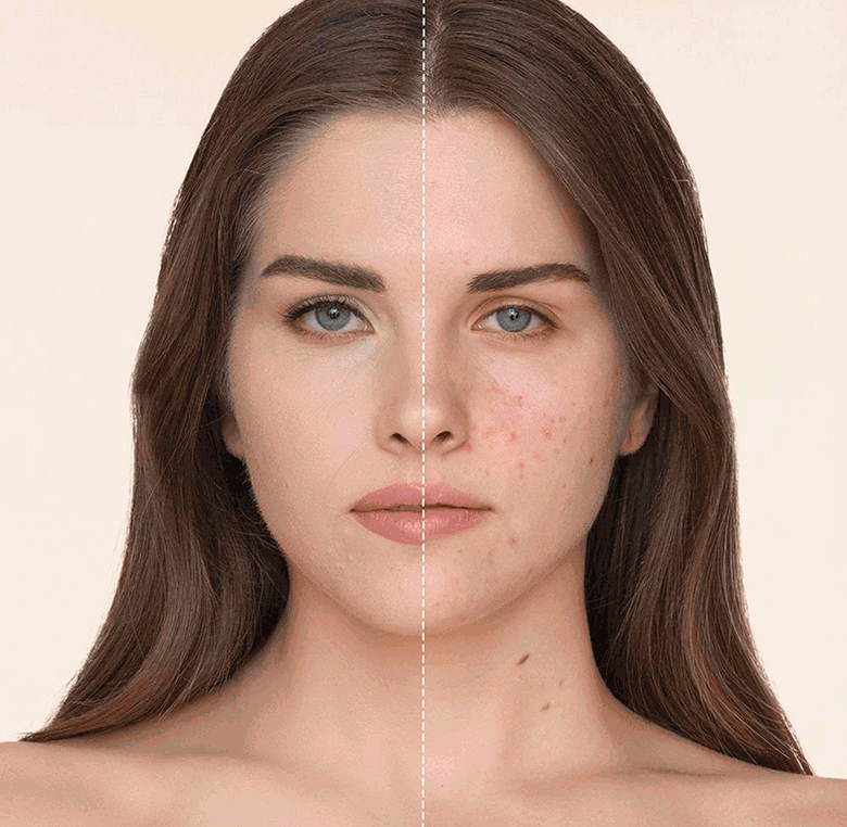 What Does the Science Mean for Your Skin?