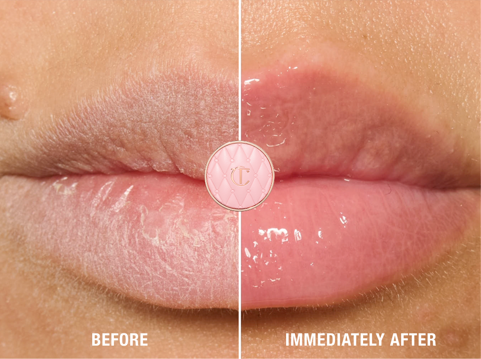 6 LIP CONCERNS. 1 MIRACLE LIP FIXER. 
